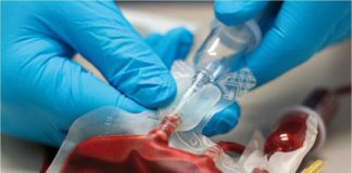 A világon már a harmadik ember gyógyult ki a HIV-fertőzésből őssejt átültetéssel A vilagon mar a harmadik ember gyogyult ki a HIV fertozesbol ossejt atultetessel